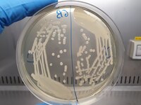 Streak plate of two clinical strains of Klebsiella pneumoniae. I used these in a large-scale analysis of K. pneumoniae metabolism. For article: https://doi.org/10.1371/journal.pbio.3003559