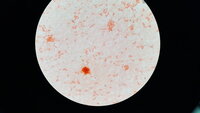 Light microscopy after a Gram stain. Cannot remember the organism