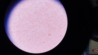 Light microscopy after a Gram stain. Cannot remember the organism