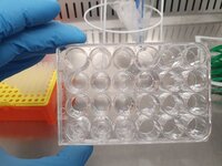 Transwells with co-cultures of various lineages of Klebsiella pneumoniae at the Department of Infectious Diseases, Monash University. For article: https://doi.org/10.1371/journal.pbio.3003559